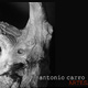 Antonio Carro